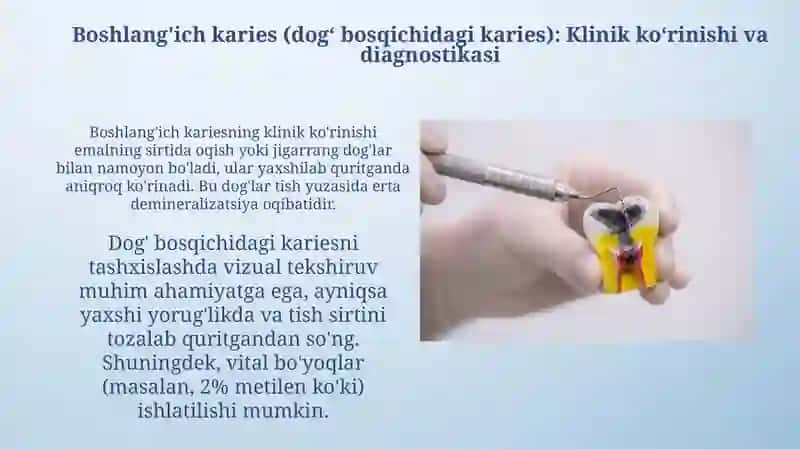 Kariyes bosqichlari. Boshlang‘ich kariyes (dog‘ bosqichidagi kariyes). Yuza kariyesi 4