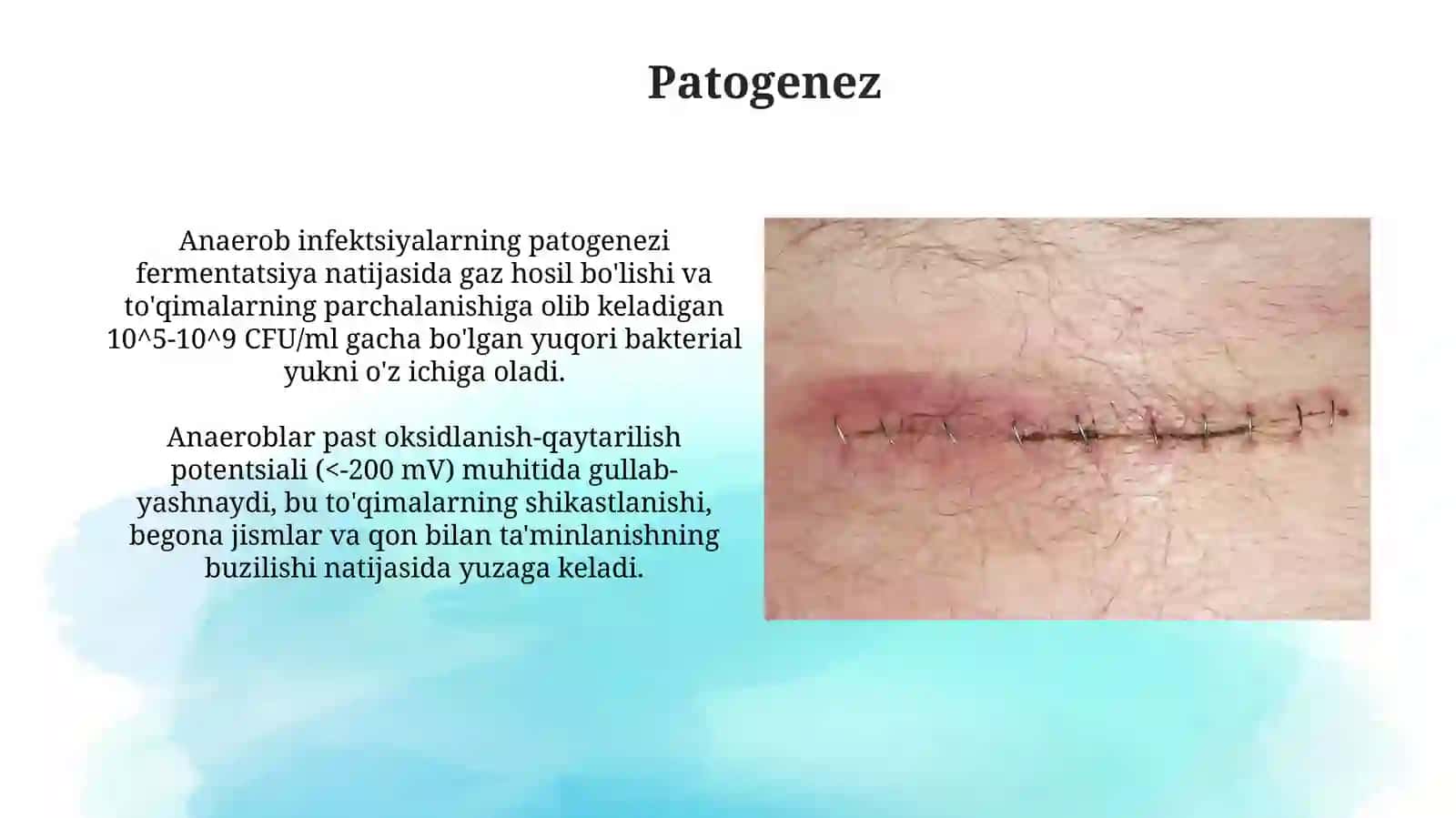 Oʻtkir anaerobxirurgikinfeksiya 4