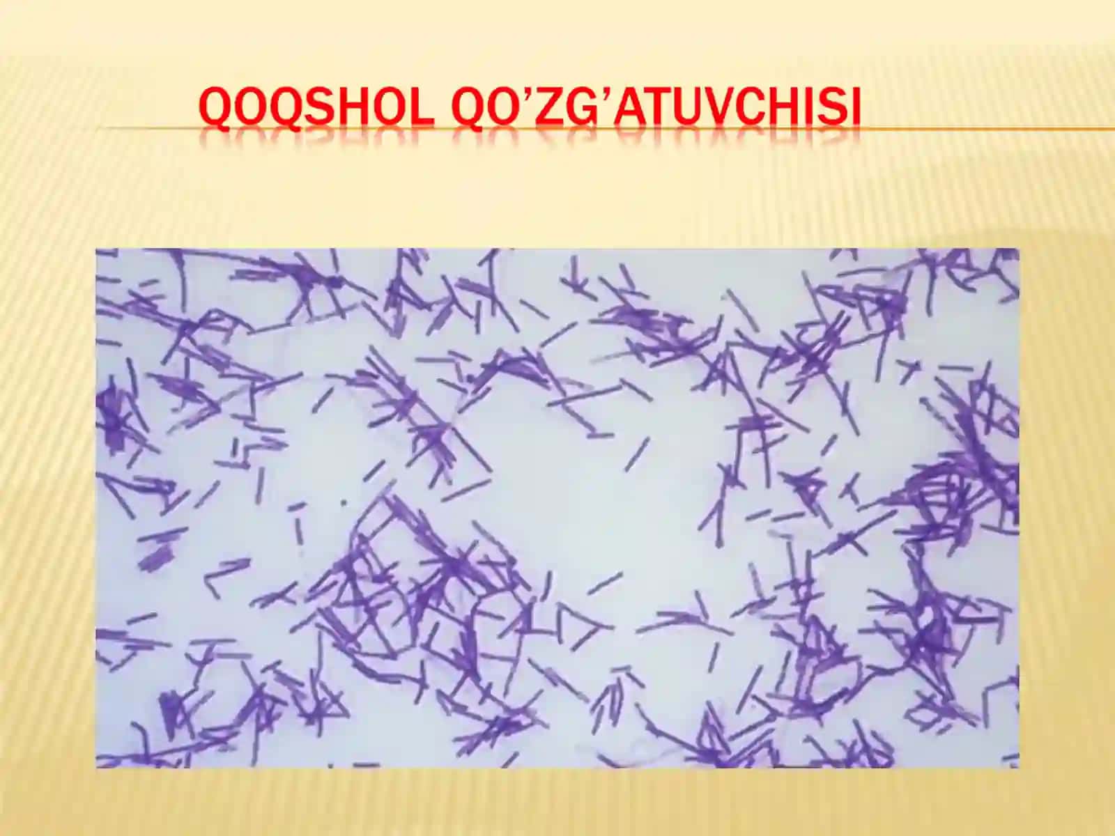 patogen anaeroblar. Qoqshol, gazli gangrena qoʻzgʻatuvchilar va ularning biologik xususiyatlari 4