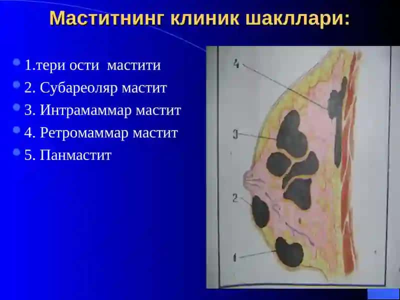 Мастит ва унинг кузгатувчилари 4