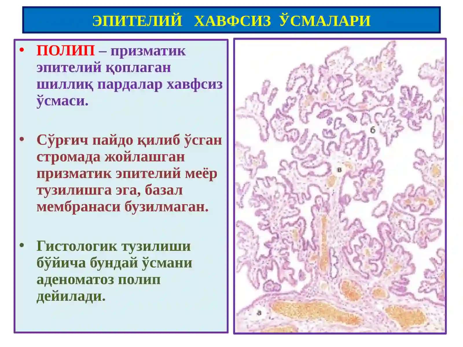 Ўсмалар.Мезенхимал ўсмалар 4