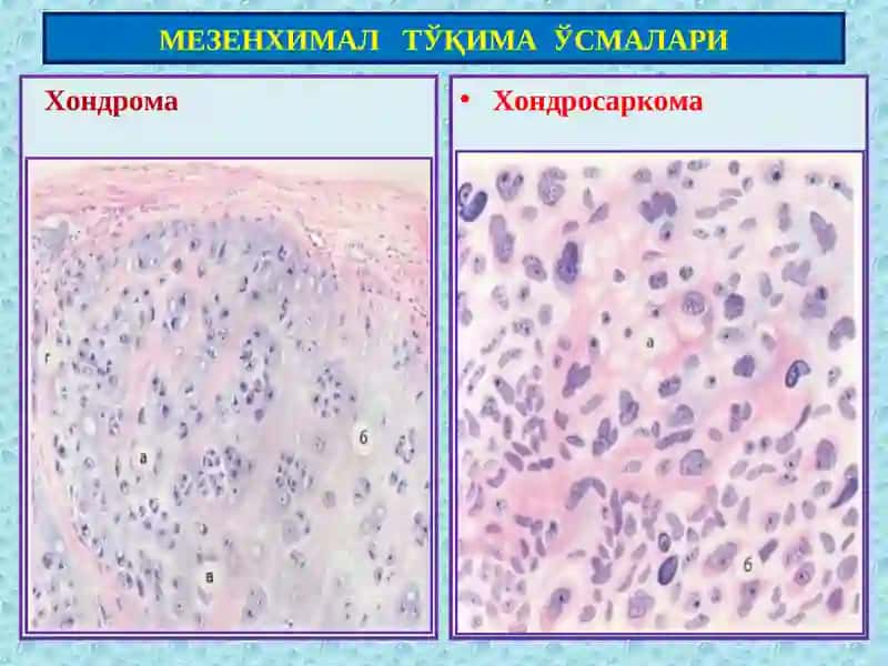 Мезенхима 4