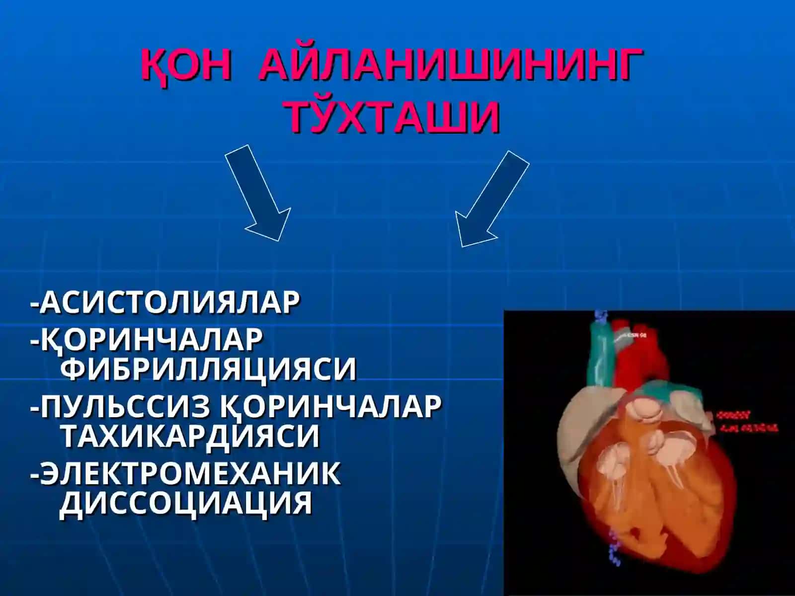 ЮРАК- ЎПКАРЕАНИМАЦИЯСИНИ ЎТКАЗИШ 4