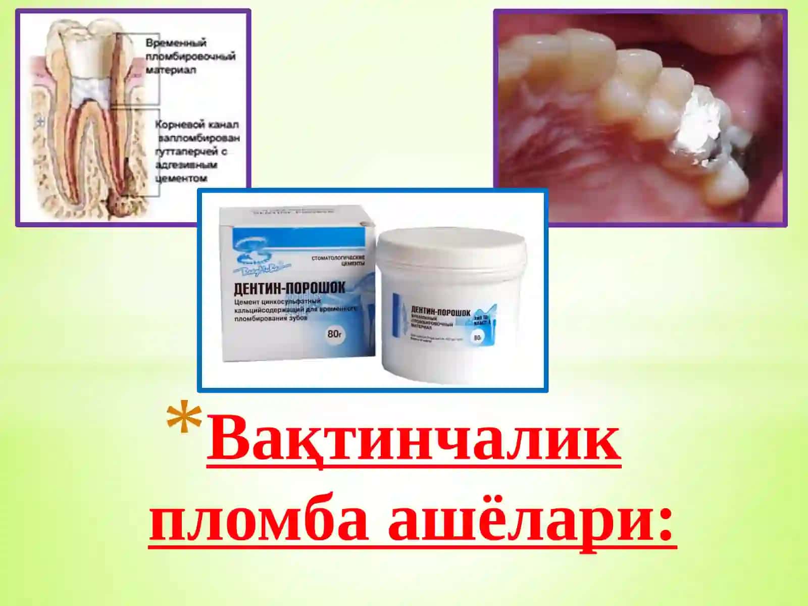 Пломба ашёларининг таснифи 4