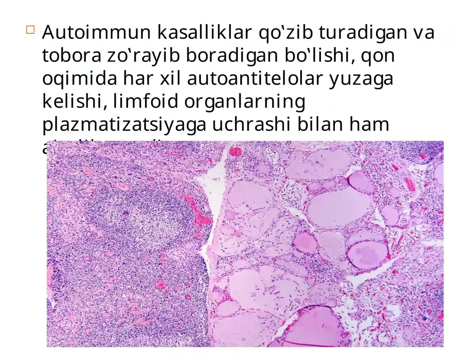 Immunologik tolerantlik nuqsonlari. Autoimmun xastaliklar 4