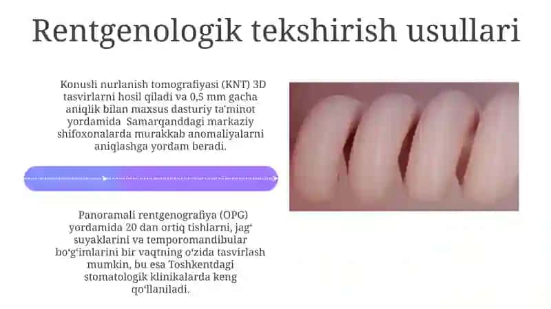 Tishlarning Rentgen Anatomiyasi 4