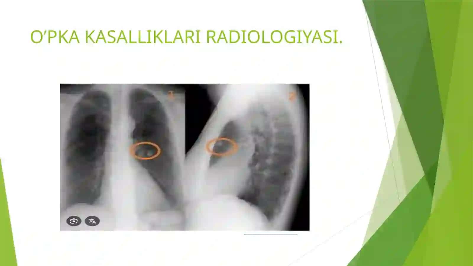 NAFAS A’ZOLARINING RENTGENANATOMIYASI 4