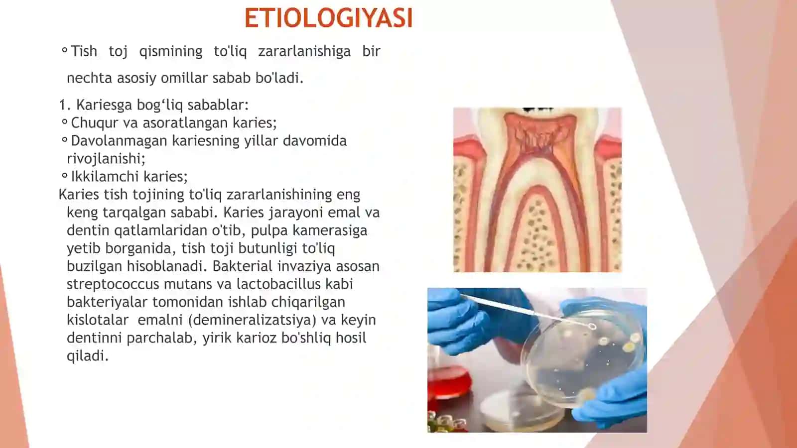 Tish toj qismining to'liq zararlanishi: etiologiya, patogenez va klinikasi 4
