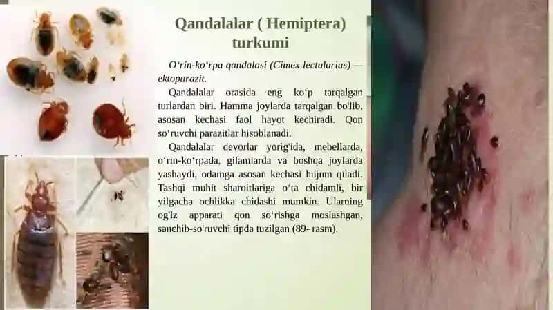 Tibbiyotda ahamiyatga ega bo‘lgan hasharotlar: bit, burga, suvarak, qandala, chivinlar- bezgak, oddiy, sariq isitma chivinlar. Iskaptopar. pashshalar- uy pashshasi, volfart, kuzgi, se-se pashshasi 4