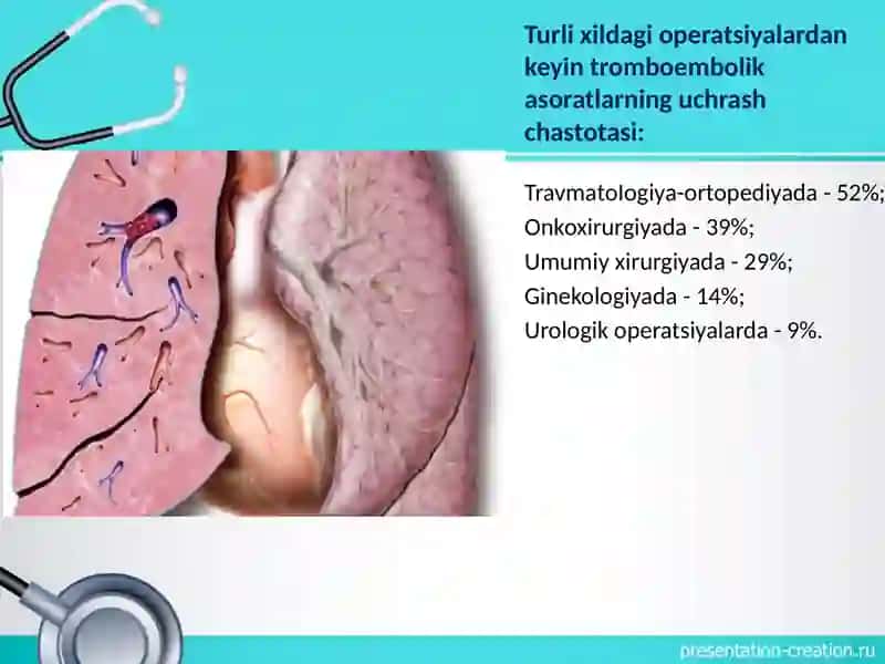 O‘pka arteriyasi tromboemboliyasi (O'ATE) 4