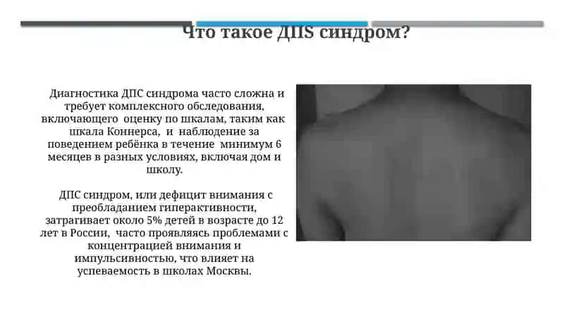 ДПС-синдром 4