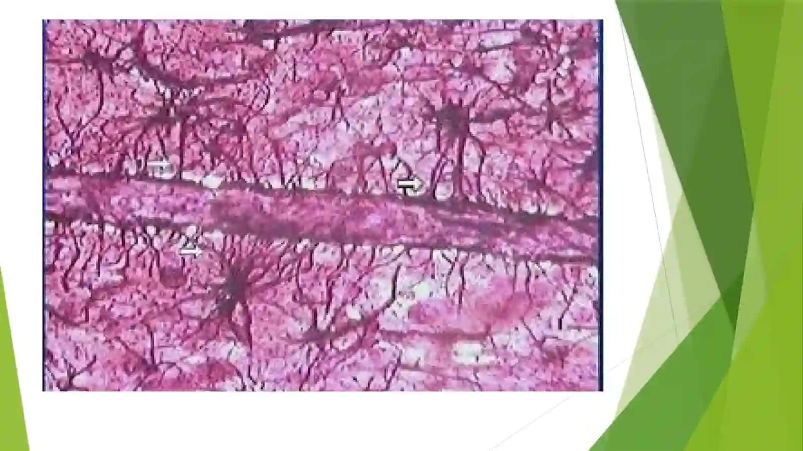 Gematoensefalik to'siq gistofiziologiyasi 4