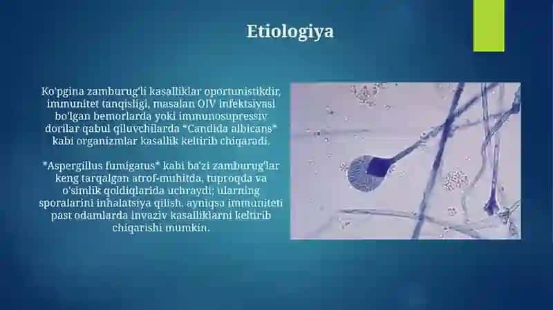 Zamburug’lar qo'zg'atuvchi kasalliklar 4