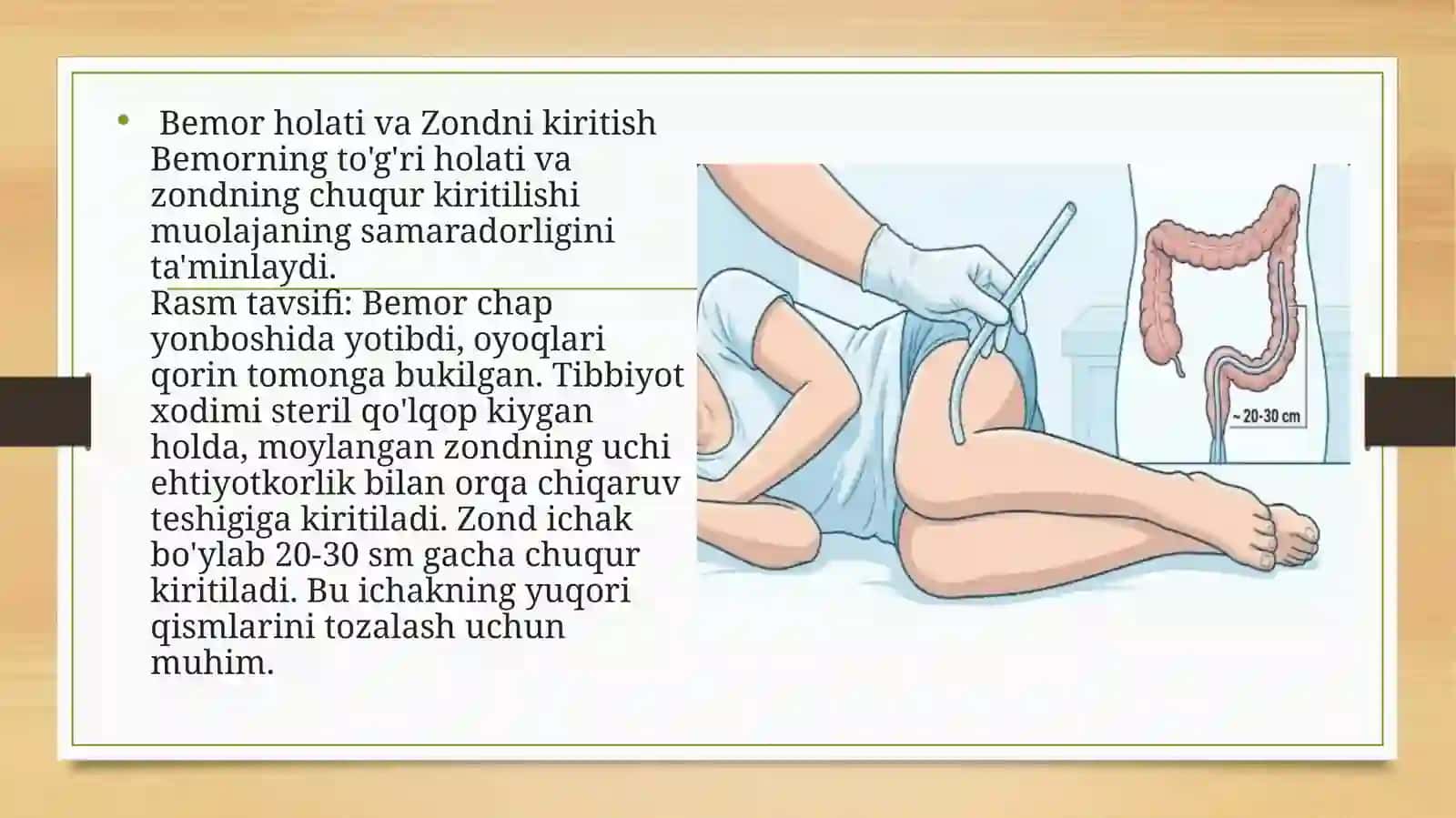 sifonli huqna 4