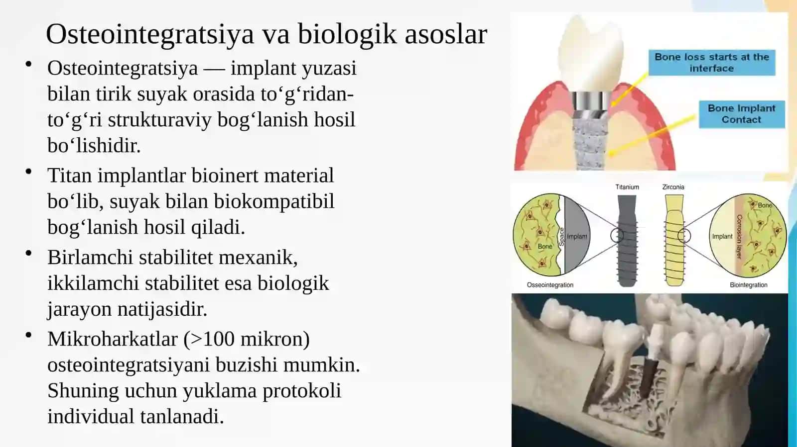 Umumiy amaliyot shifokori stomatologining zamonaviy klinik  protokollar asosida tish implantlaridan 4