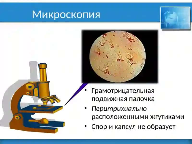 Брюшной тиф 4
