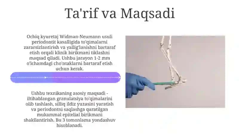 Ochiq kuretaj Widman Neumann usuli 4