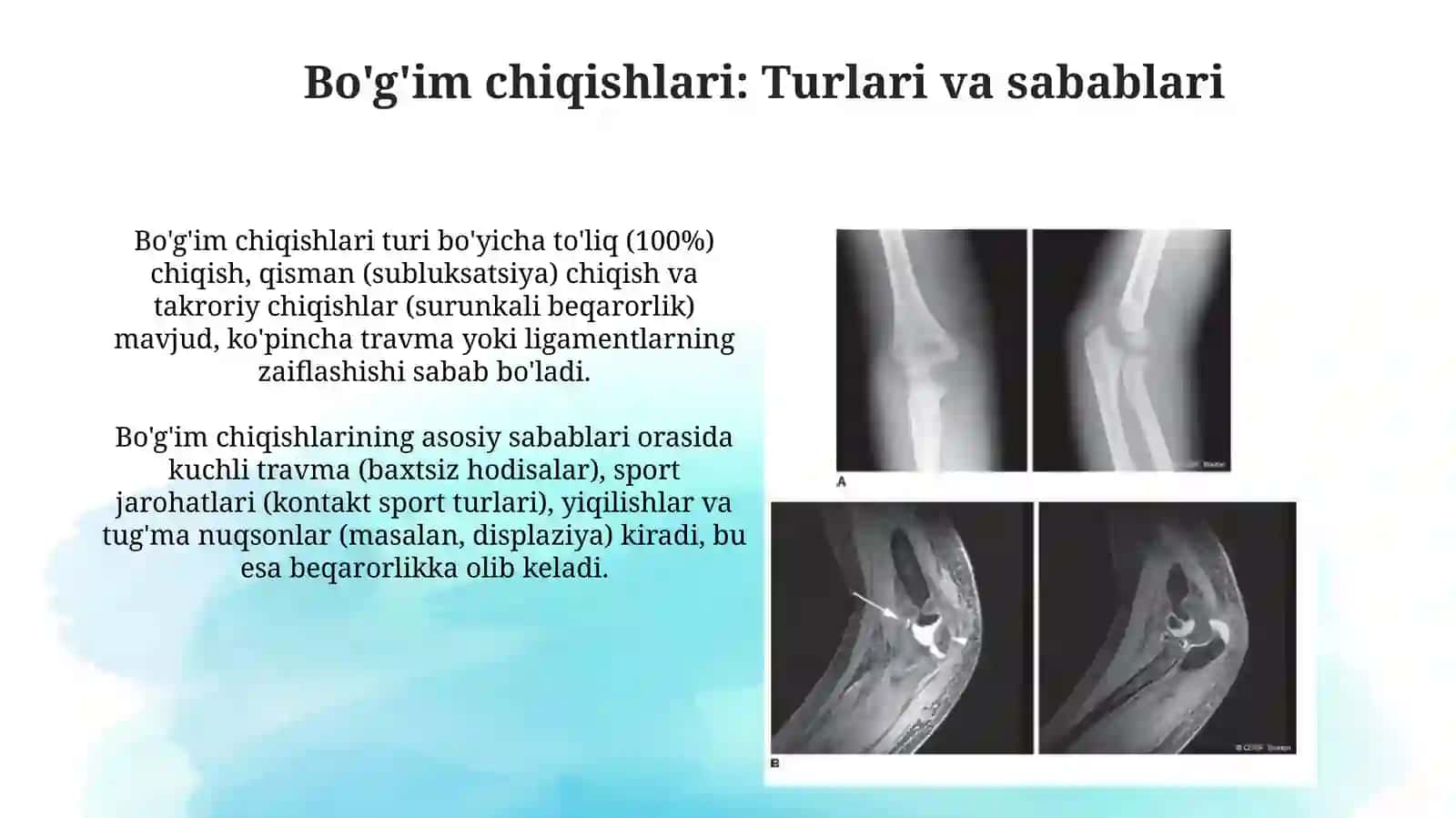 Suyaklar sinishi va boʻgʻimlar chiqishi.Transportimmobilizatsiyatsiyasi.Yatrogeniya 4