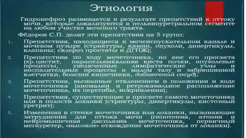 Гидронефроз 4