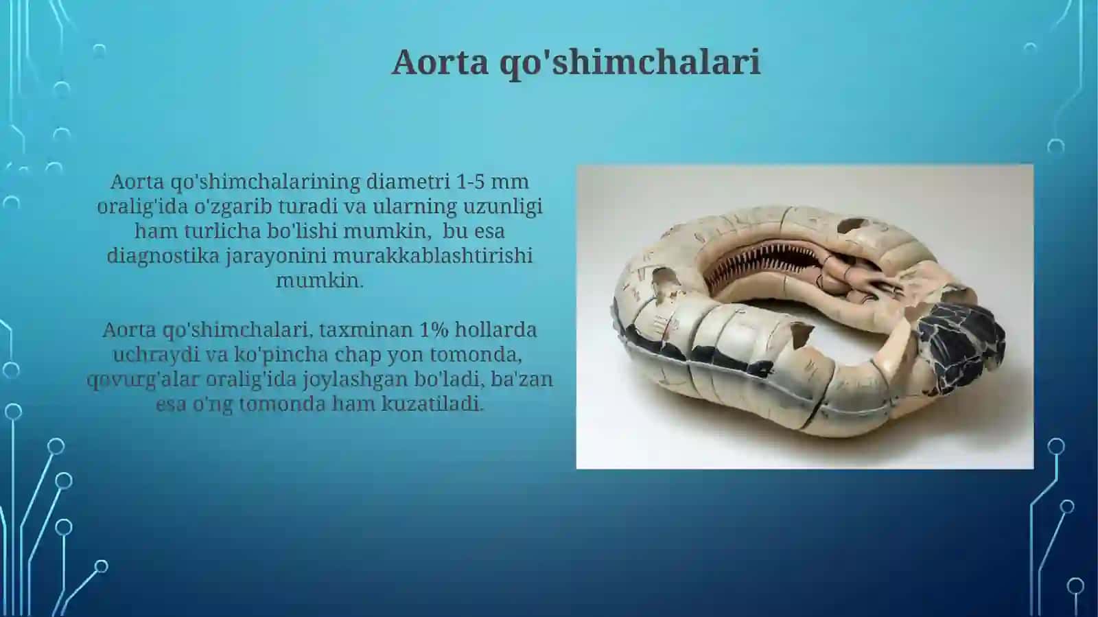 Aortaning Anatomik Oʻzgarishlari 4