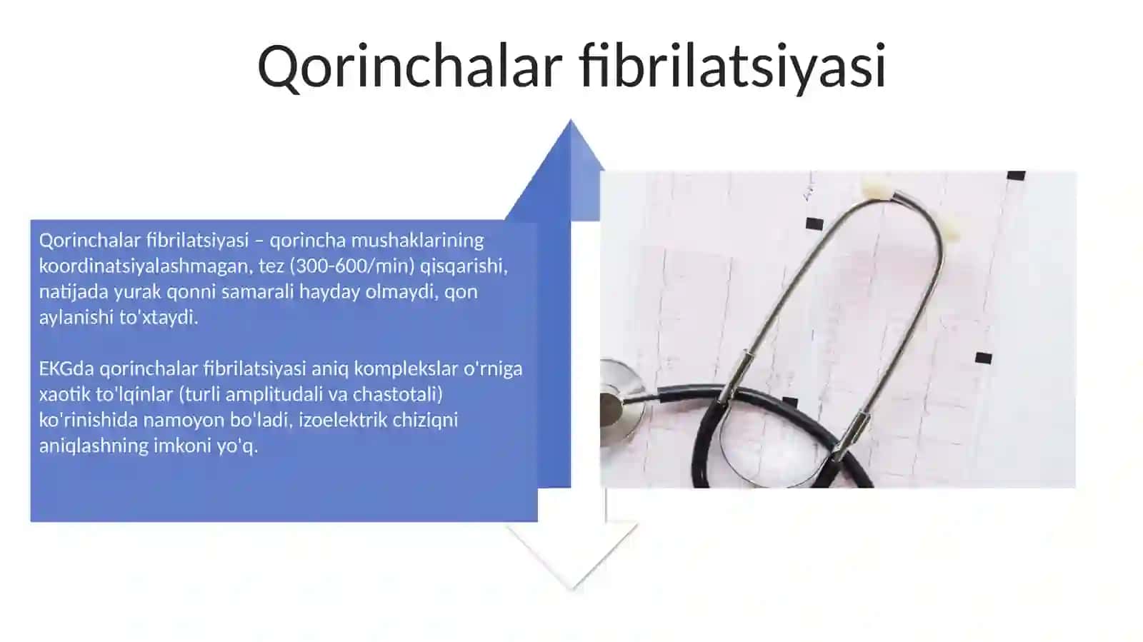 Aritmiyalarni elektrokardiografik (EKG) diagnostikasi 4