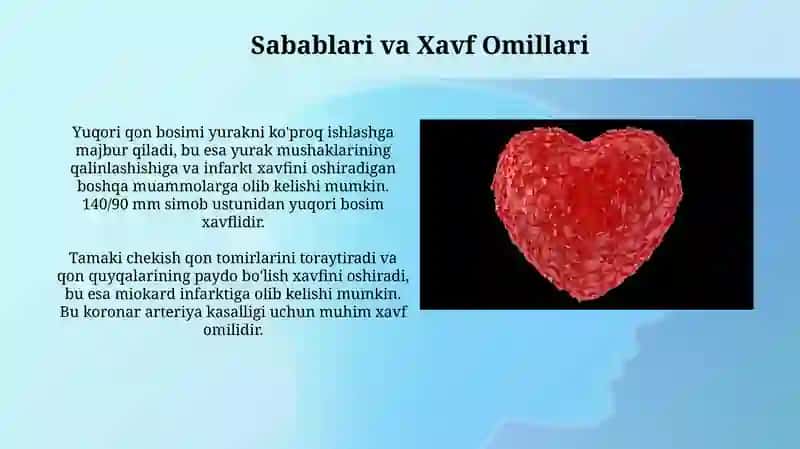 Miokard infarkt 4