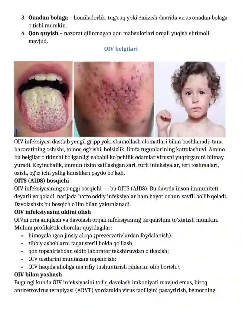 111-SONLI BUYRUQ ASOSIDA OIV INFEKSIYASI 4
