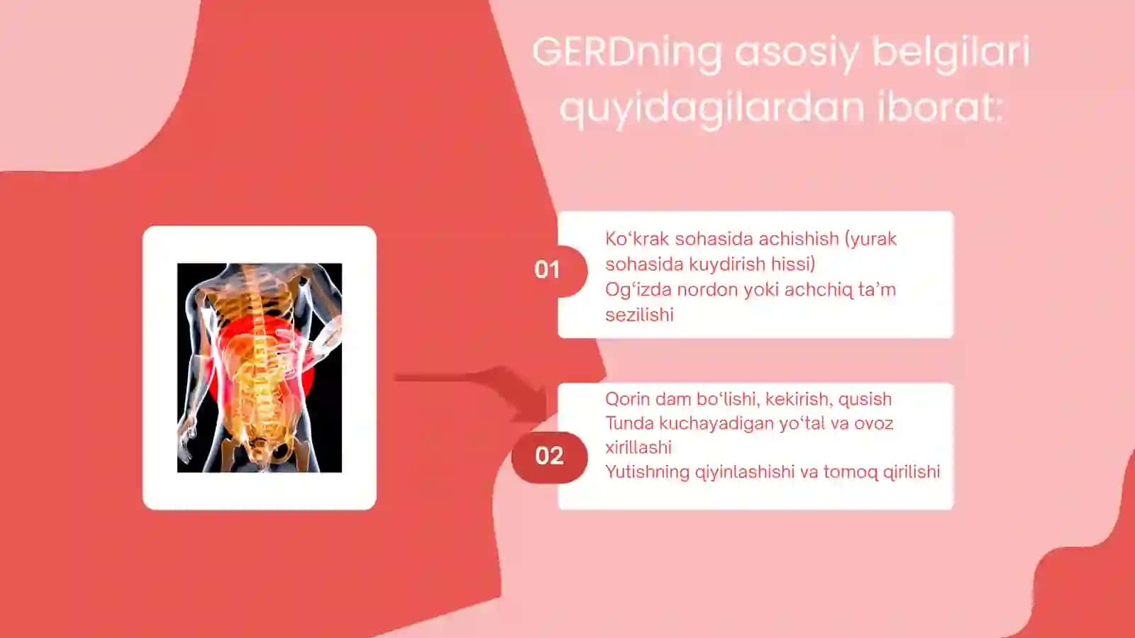 Gastroezofagal reflyuks 4
