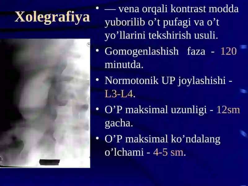 GEPATOBILIAR TIZIMI KASALLIKLARINI NUR DIAGNOSTIKASI 4