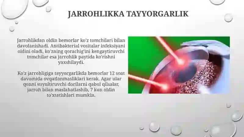 Ko'z jarrohligining asosiy usullari 4