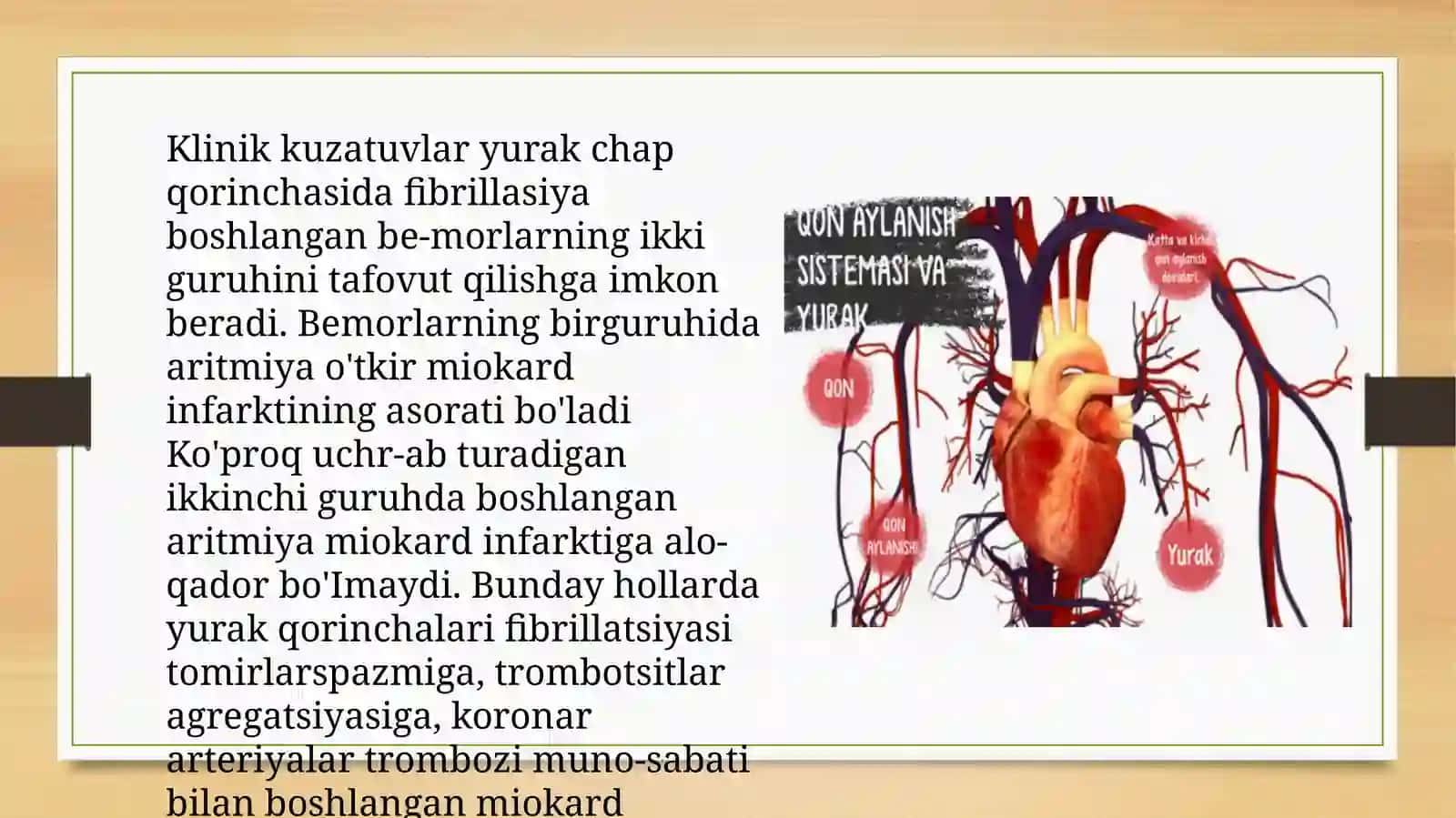 Tasodifiy yurak oʻlimi sindiromi 4