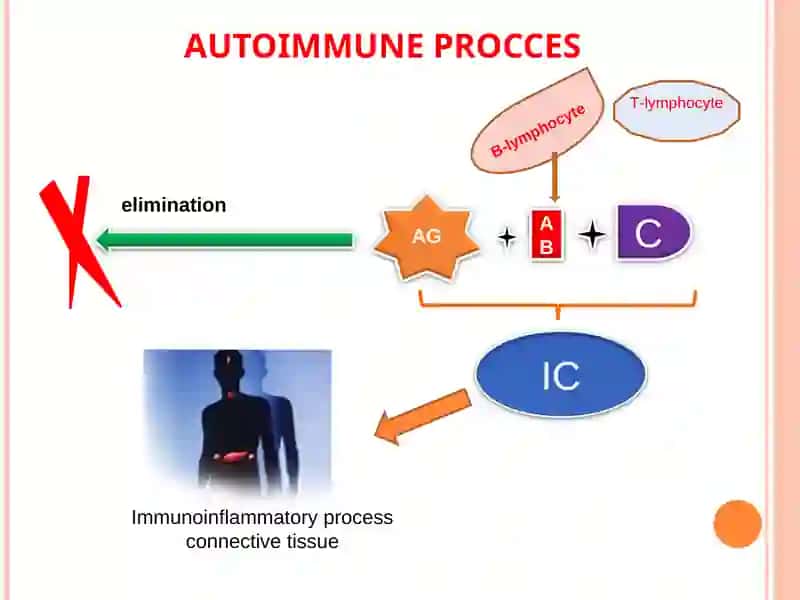 Differential diagnosis of diffuse connective tissue diseases 4