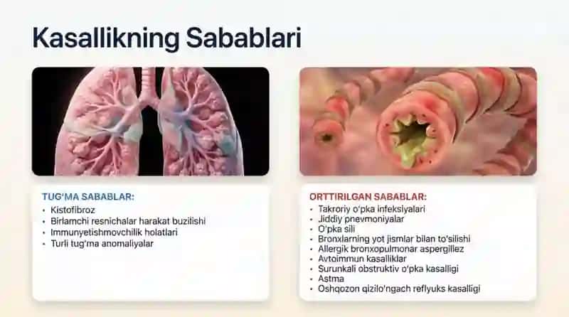 Bronxoekatik Kasallik diagnostikasi 4