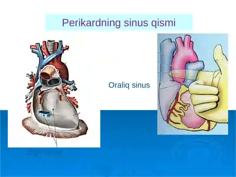 Perikard kasalliklari.Yurak o'smalari. Yurak trasplantologiyasi 4