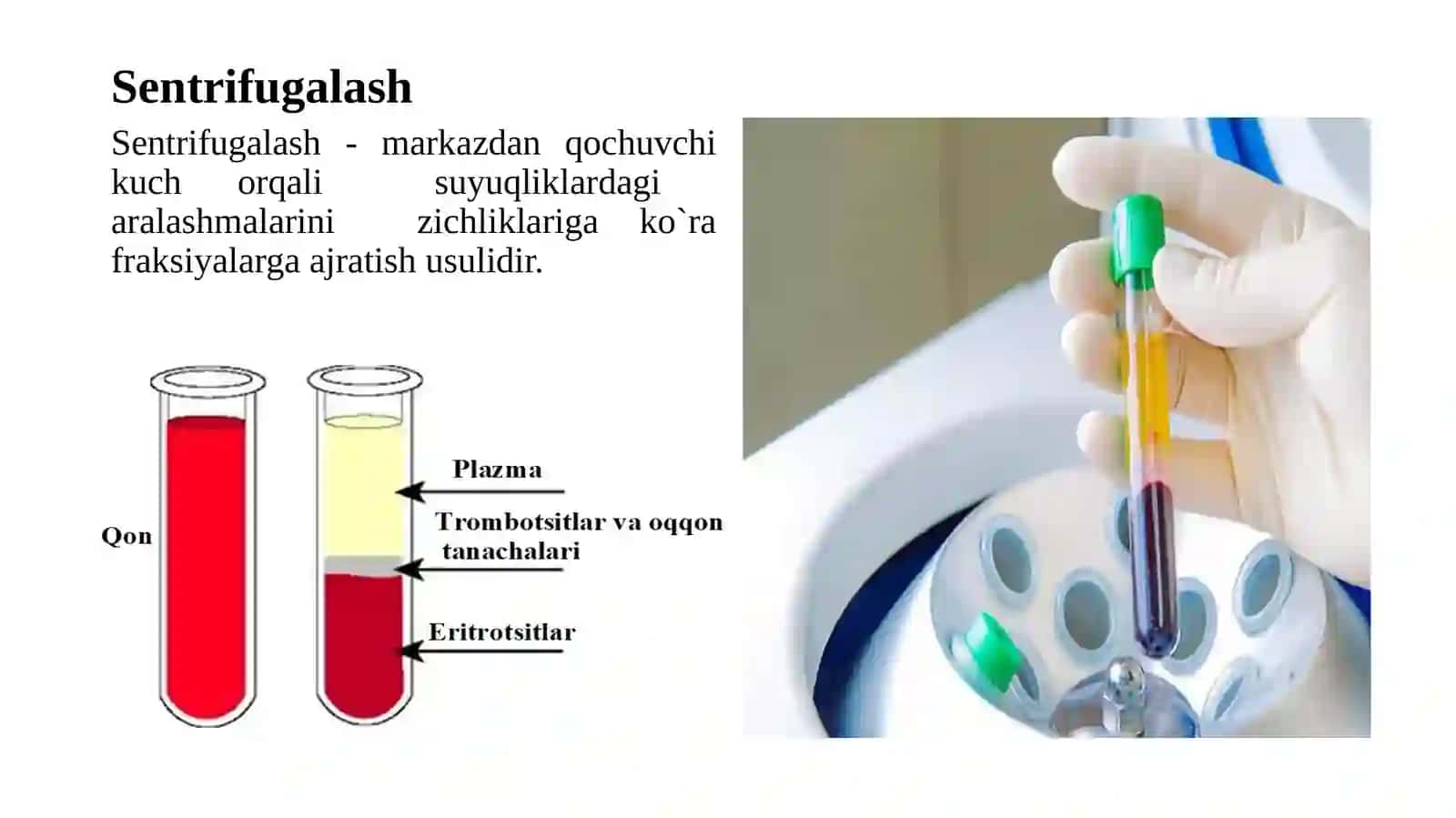 11-Amaliy.Qonbiokimyosi. Gemmetabolizmivatemiralmashinuvi 4