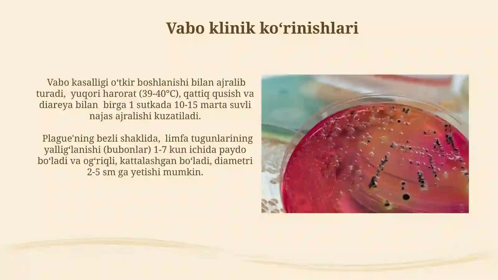 Mikrabiologiya: Brutsellyoz va o'lat qo'zg'atuvchilari 4