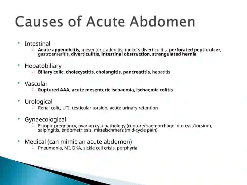 Acute abdomen 4