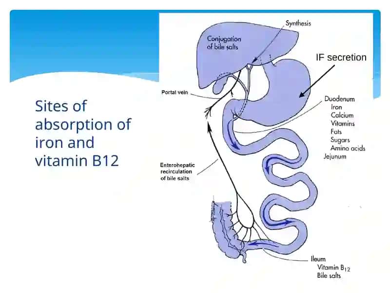 Anemia 4