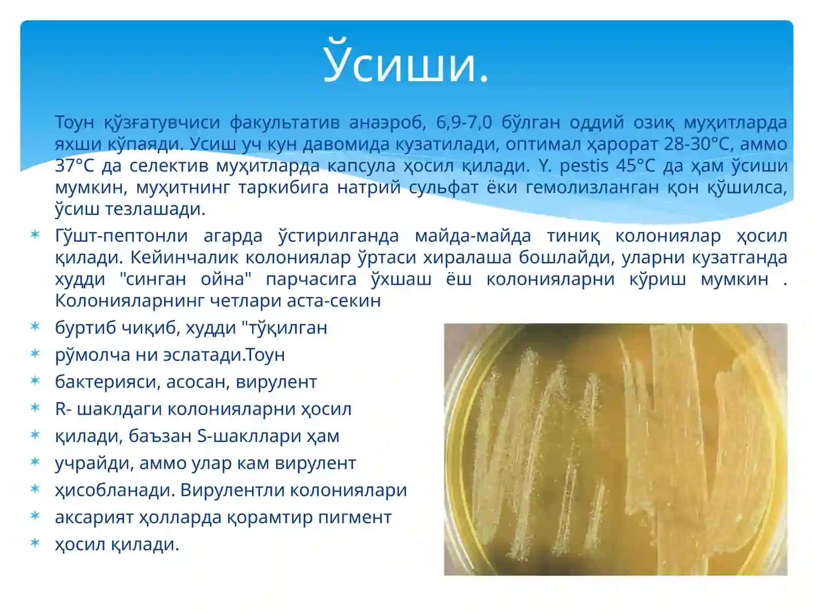 Тоун(ўлат)ўткир,ўтахавфли антрапозооноз инфекция 4
