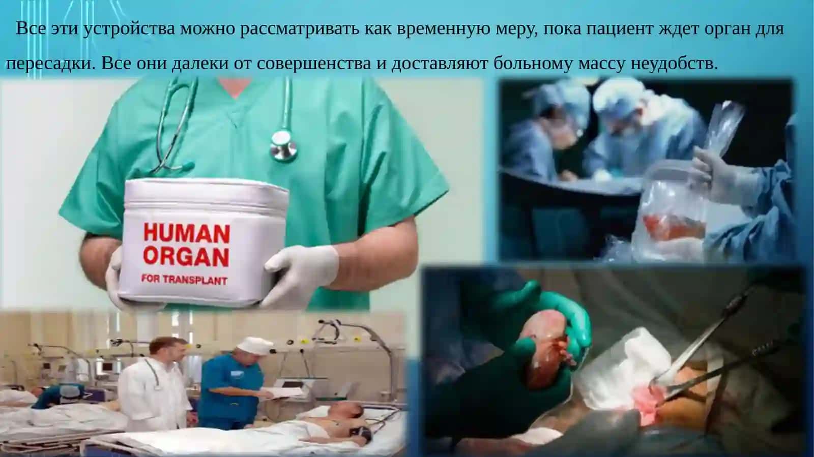 Проблемы создания искусственных органов для трансплантологии 4