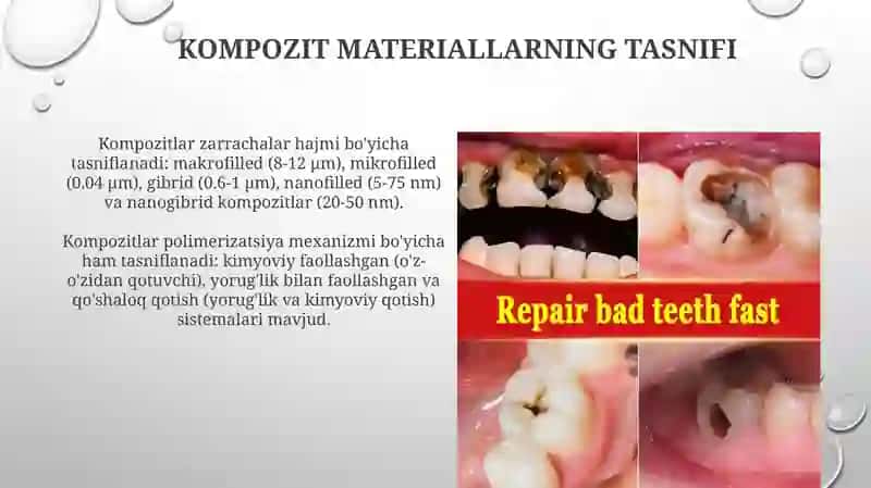 Stomatologiyada kompozit materiallar 4