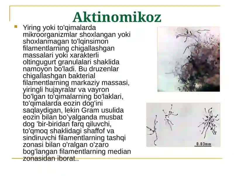 Surunkali va parazitar xirurgik infektsiya 4