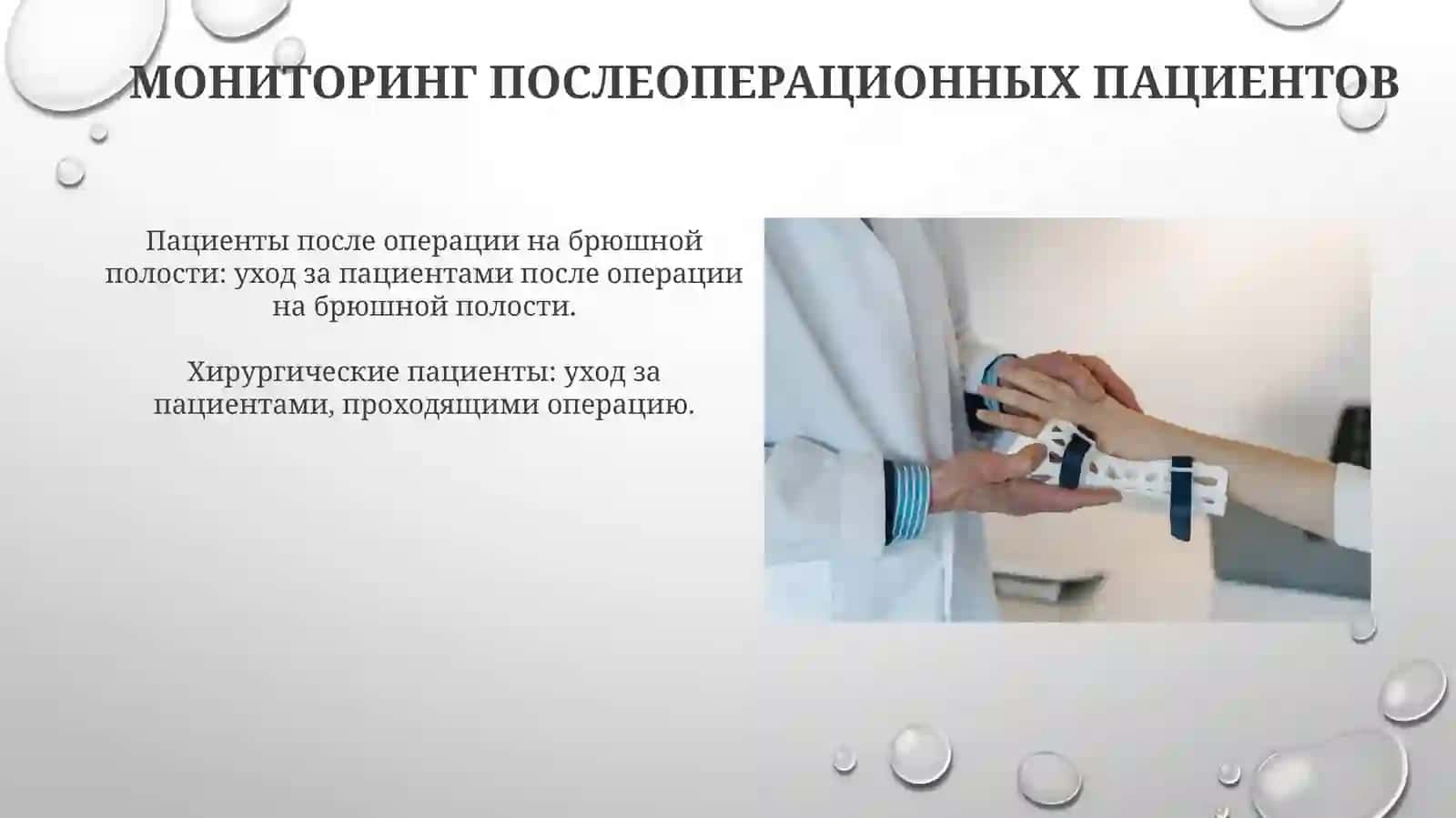 Медицинские вмешательства после абдоминальной операции 4