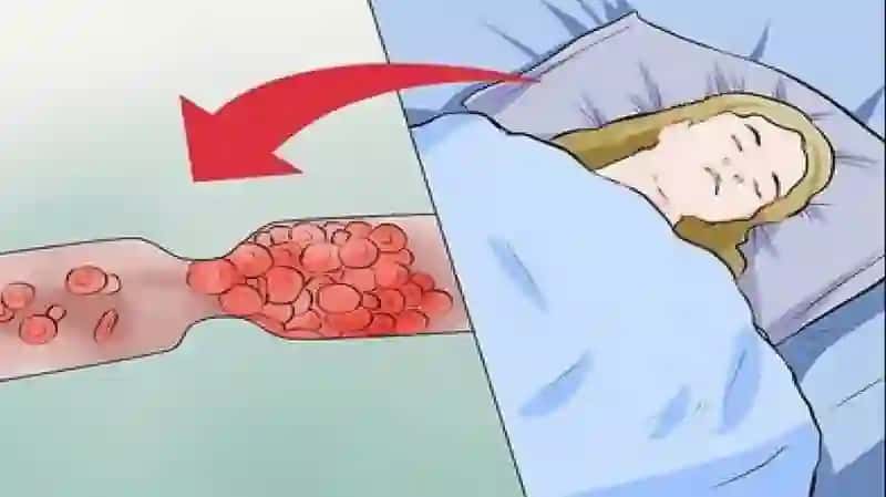 Eklampsik koma. Klinikasi, diagnostikasi, tez tibbiy yordam 4