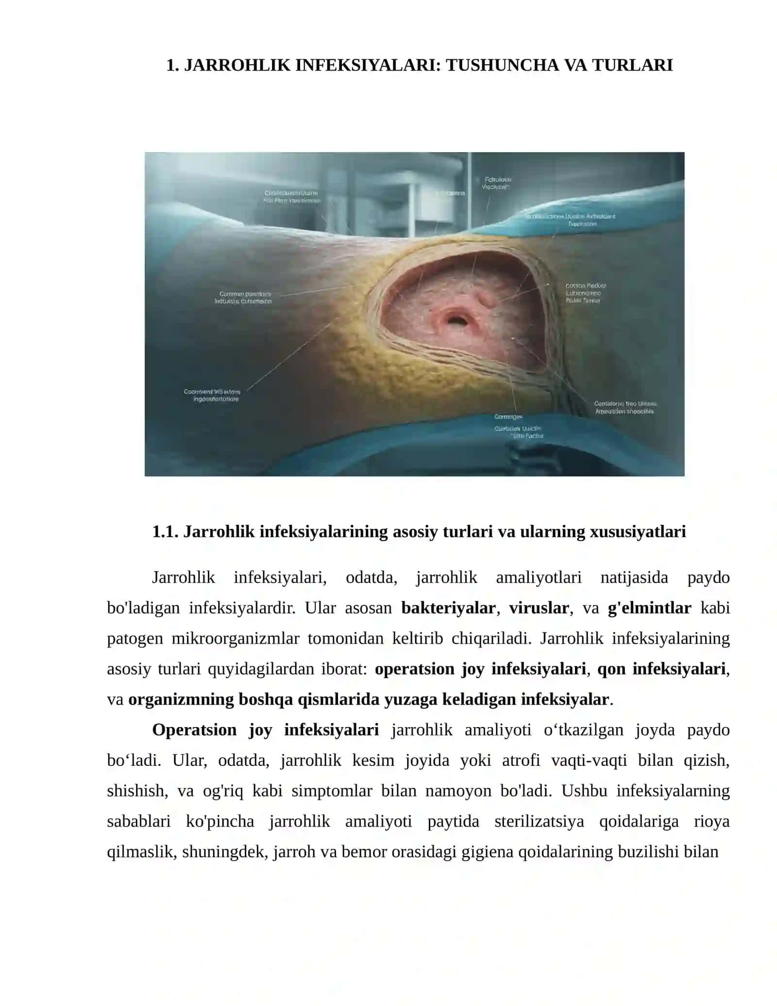 JARROHLIK INFEKSIYALARI 4