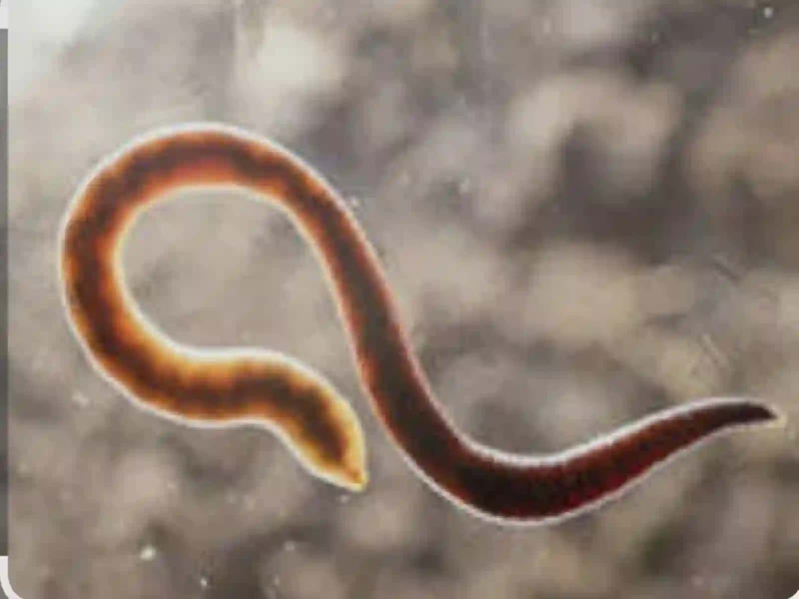 Odam askaridasining biologiyasi va ahamiyati 4