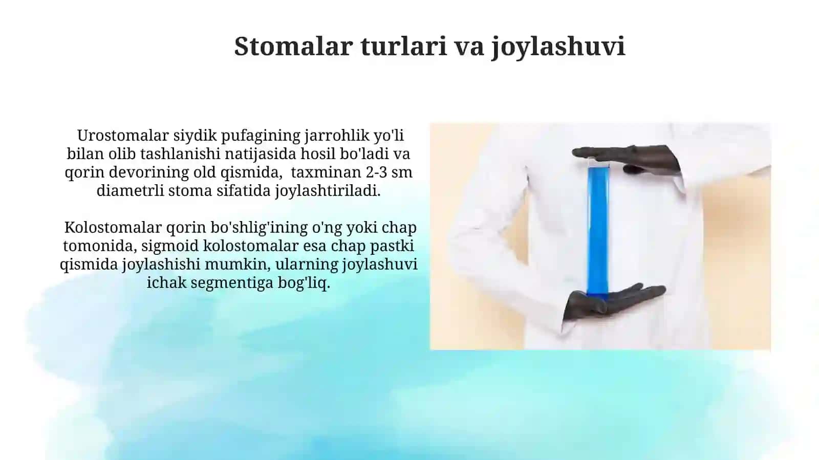 Hirurgik stomani parvarish qilish 4