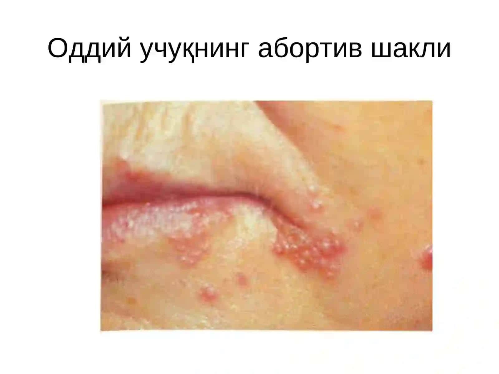 Вирусли касалликларнинг таснифи 4