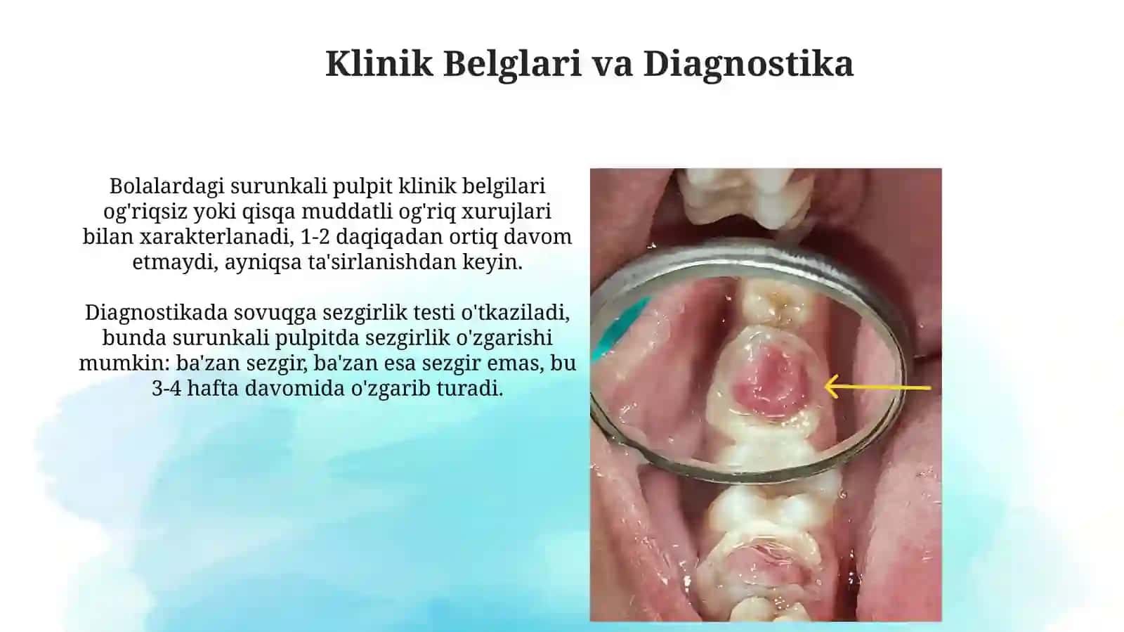 Surunkali pulpitlar 4