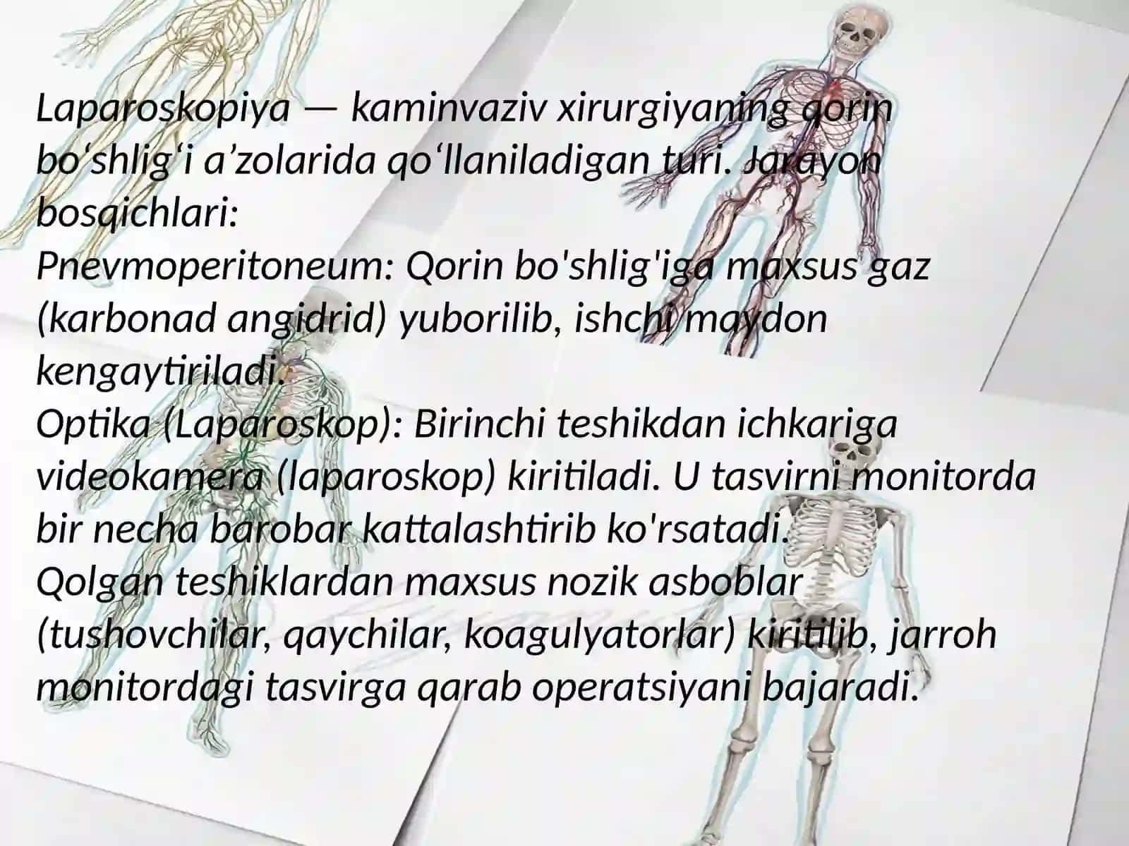 Laparoskopik xirurgiya. Laparoskopik splenektomiya. Oshqozon osti bezi xirurgiyasi 4
